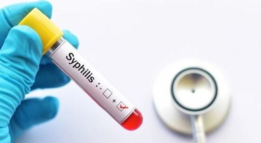 Preocupa el avance de la sífilis: se triplicaron los casos en adolescentes y recién nacidos | Actualidad