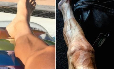 Así quedan las piernas de un ciclista tras el Tour de France | Deportes