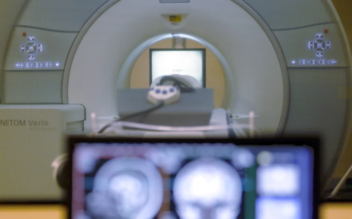 Un hombre murió atrapado por un resonador magnético: "Me saludó con la mano", contó su esposa | Internacionales