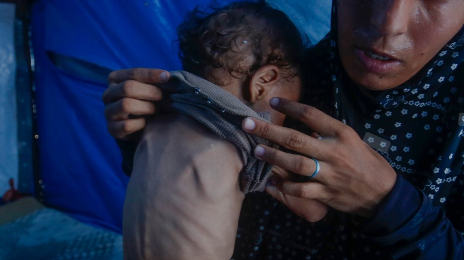 Gaza: murió una beba de cinco meses cuyo peso era menor al del día de su nacimiento | Internacionales