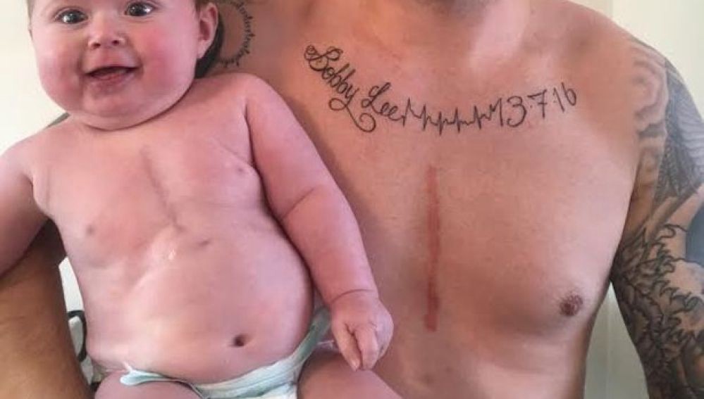 Un padre se tatuó la cicatriz que su hijo tiene tras ser operado a corazón abierto | Curiosidades
