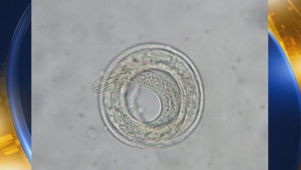 Alerta en Estados Unidos por un parásito letal que ataca el cerebro humano | Curiosidades