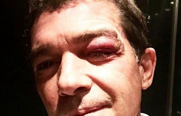 Así quedó Antonio Banderas tras accidentarse durante la filmación de su nueva película | Espectáculos