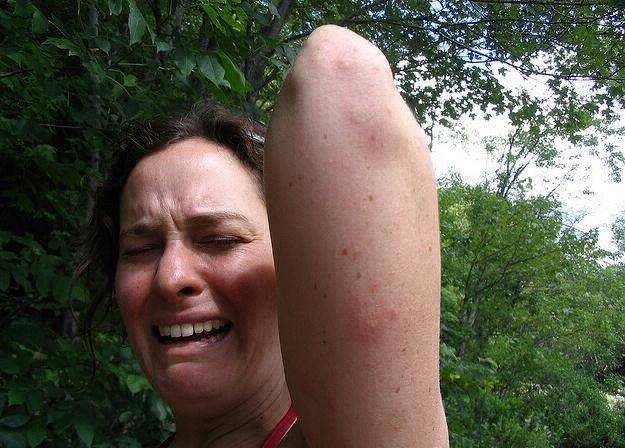 Las cinco razones por las cuales los mosquitos pican a unas personas y a otras no | Curiosidades