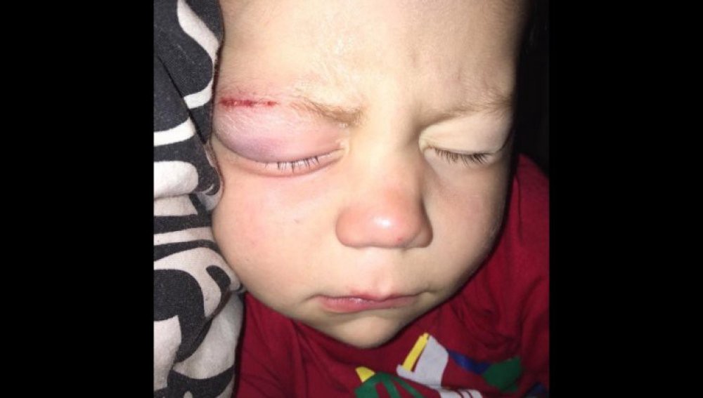 Indignante: llevaron a un nene al hospital y por un error médico le pegaron los ojos con pegamento | Curiosidades
