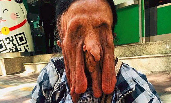 El extraño caso de la mujer con la "piel derretida" que no quiere operarse por miedo a morir | Curiosidades