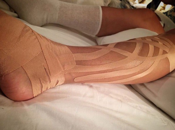 Así quedó la pierna de Paulina Rubio luego de su caída al vacío en pleno concierto | Espectáculos