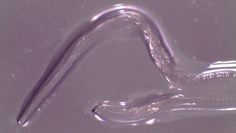 Estados Unidos: extrajeron 14 gusanos del ojo de una mujer | Curiosidades