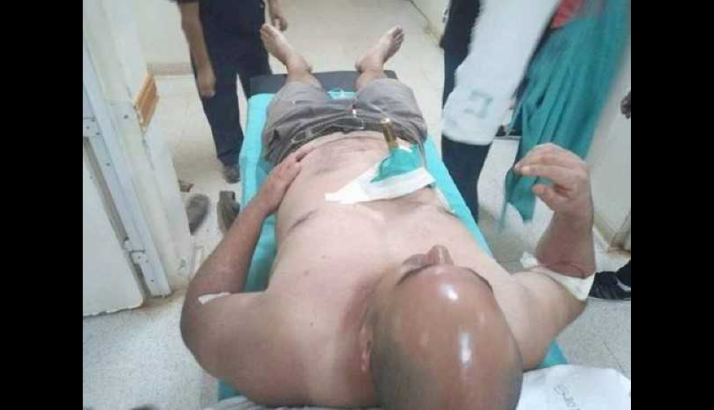 Corrientes: lo apuñalaron y fue a pedir ayuda a la comisaría, con el cuchillo en el ombligo | Curiosidades