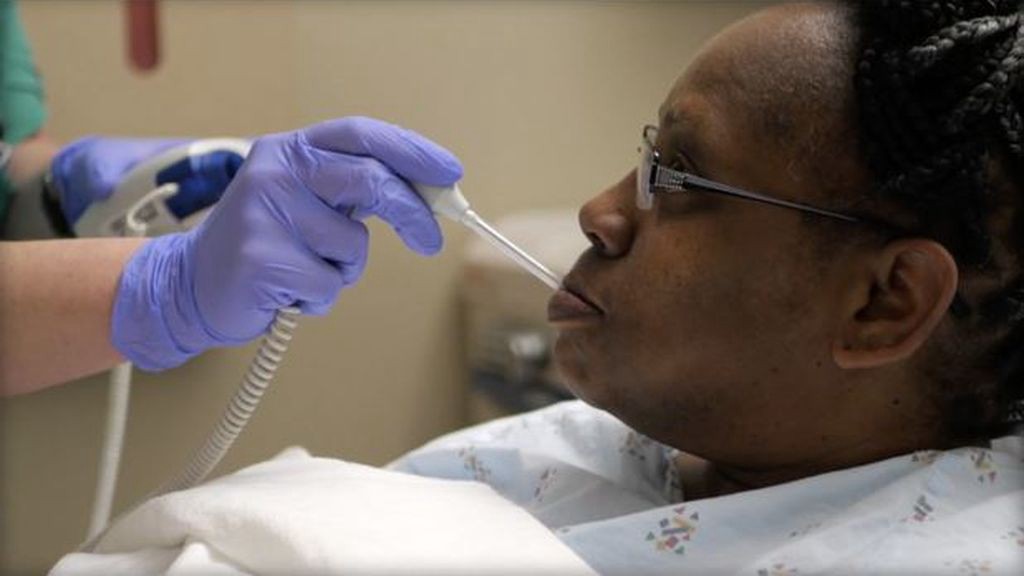 El extraño caso de la mujer perdía líquido del cerebro por la nariz | Curiosidades