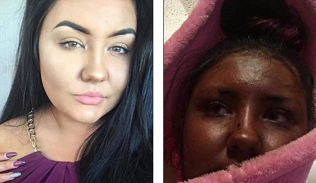 Se puso autobronceador, quedó verde como Fiona de Shrek y es viral | Curiosidades