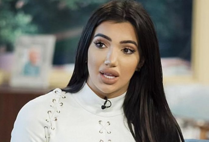 El calvario de una mediática inglesa tras una cirugía de nariz: "No puedo oler, ni respirar" | Espectáculos