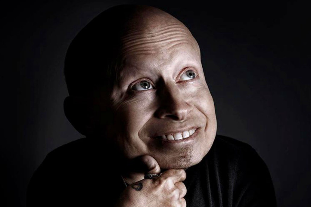 Murió Mini Me, el villano de las películas de Austin Power | Espectáculos