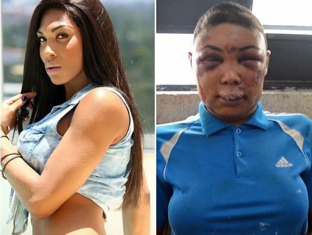 Mujer transgénero brasileña acusa a la policía de darle brutal paliza | Internacionales