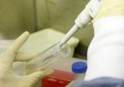 En un caso único en el mundo, desapareció el HIV en una joven francesa | Internacionales