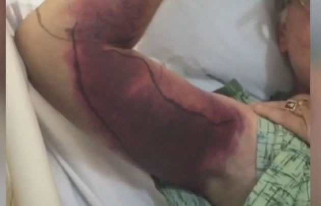 La "selfie" más cara: lo picó una víbora y debe pagar más de 150 mil dólares | Internacionales