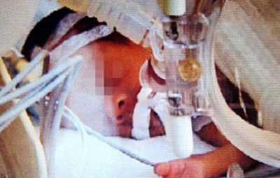 Bebé despierta en la morgue antes de ser cremado | Internacionales