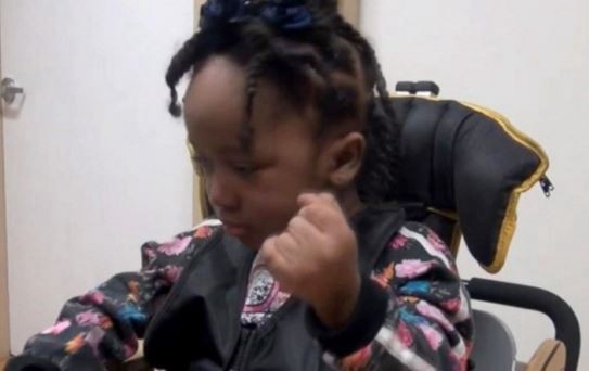 Una nena de 4 años sufrió daño cerebral por error de una dentista | Internacionales