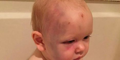 Padres denuncian en Facebook a una niñera que le pegó a su bebé y está libre | Internacionales