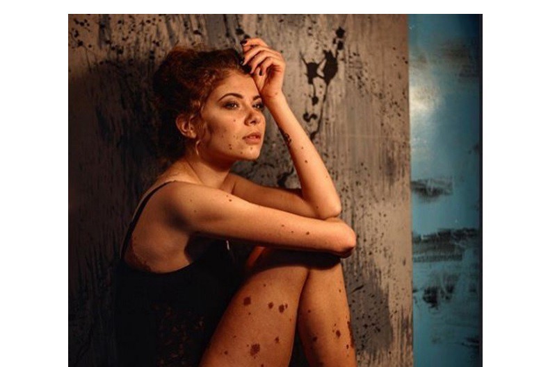 La historia de empoderamiento de la "mujer dálmata" | Internacionales