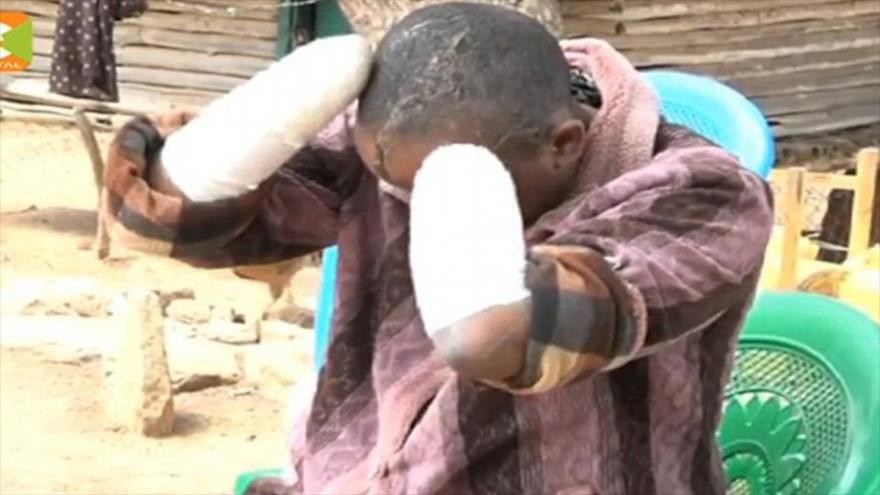 Como su mujer no quedaba embarazada, le cortó las manos con un machete | Internacionales