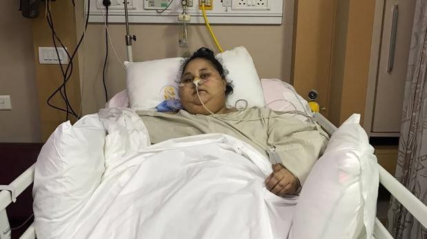 La mujer más obesa del mundo que perdió 100 kilos en la India | Internacionales