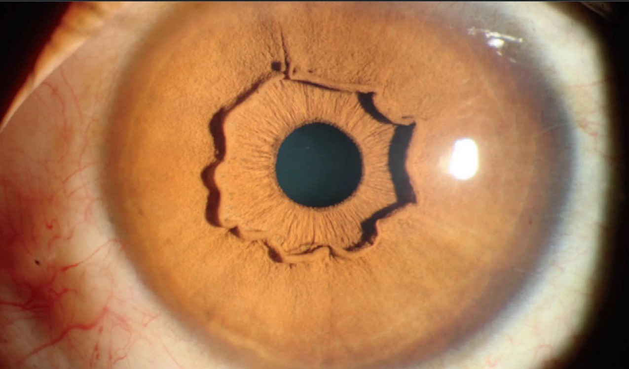 Los ojos de una mujer en China sorprenden a los especialistas | Internacionales