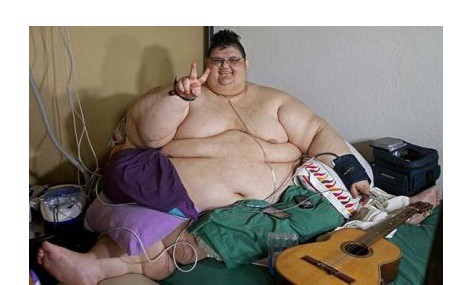 Salió "bien" la operación al hombre más obeso del mundo | Internacionales