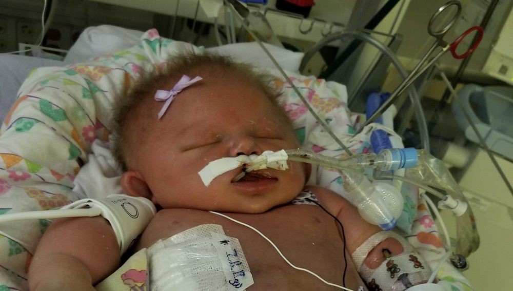 Murió una recién nacida al contraer meningitis: creen que la contagiaron con un beso | Internacionales