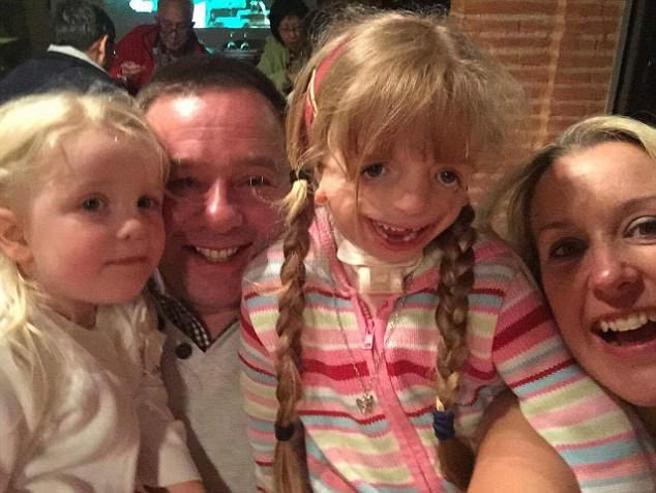 "Es una de las niñas más felices": la inspiradora historia de la nena que debió operarse 29 veces la cara | Internacionales