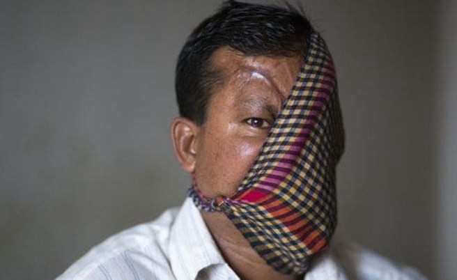 La historia del hombre al que un tigre le destrozó la cara hace más de 20 años | Internacionales