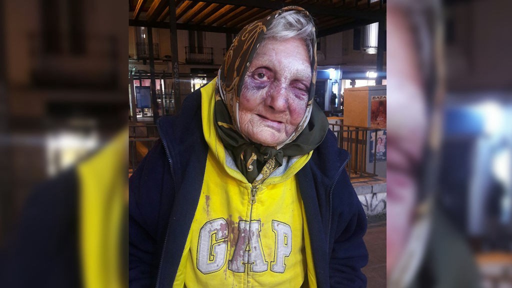 Conmoción en Madrid: un grupo de hombres golpearon brutalmente a una anciana que vivía en la calle | Internacionales