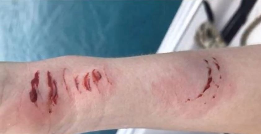 La ataca un tiburón mientras su esposo la filmaba en la luna de miel | Internacionales