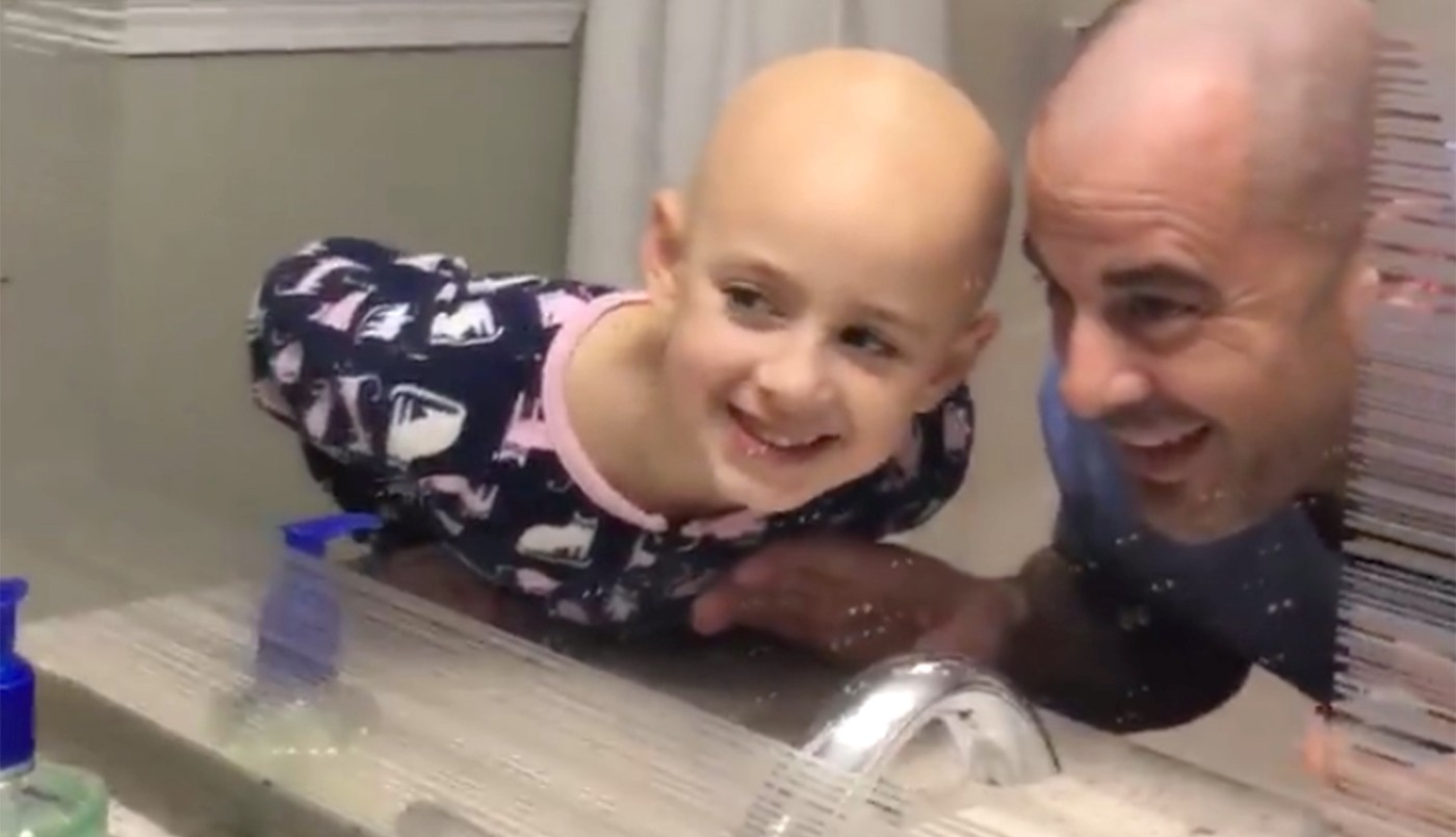 El padre que se rapó para acompañar a su hija que sufre alopecia | Internacionales