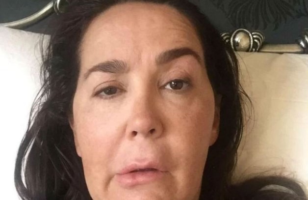 Se inyectó bótox y contrajo una bacteria: ahora sufre parálisis facial y convulsiones | Internacionales