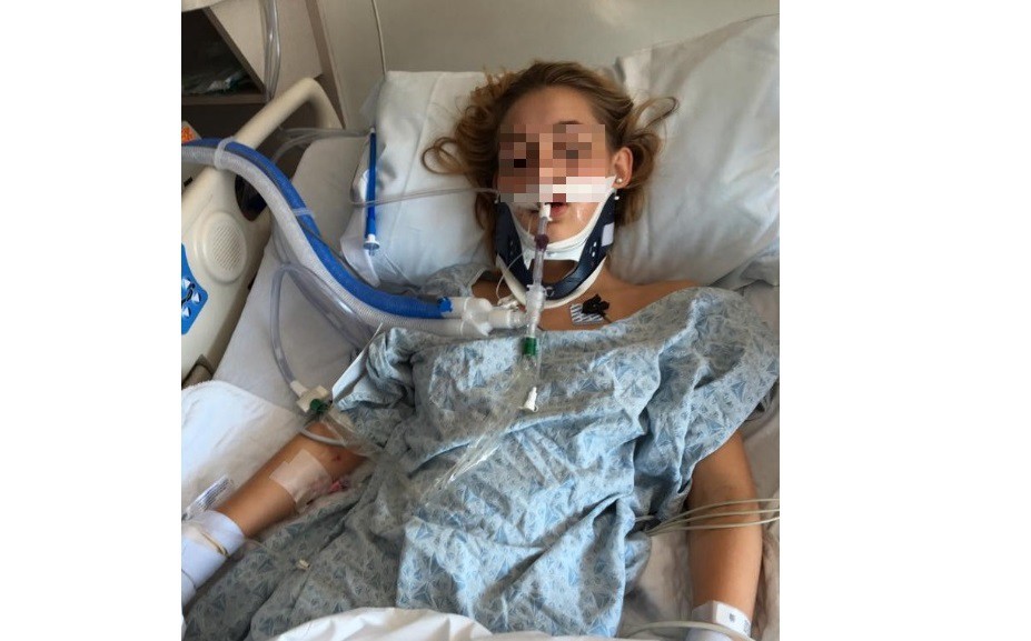 Publicó las fotos de su hija adolescente en coma para concientizar sobre el riesgo del alcohol | Redes