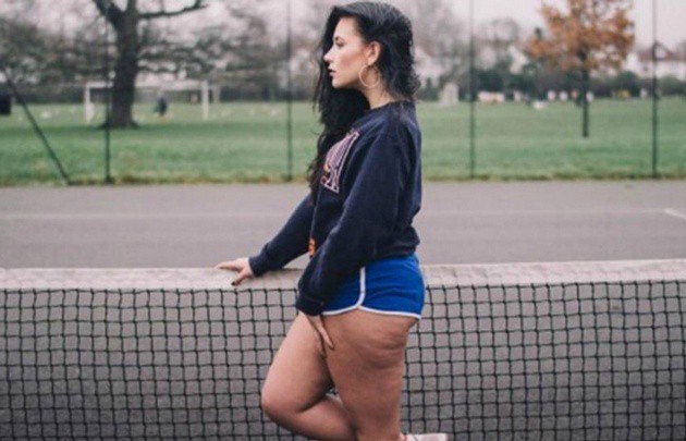 Fotos virales: mujeres que muestran sus celulitis | Redes