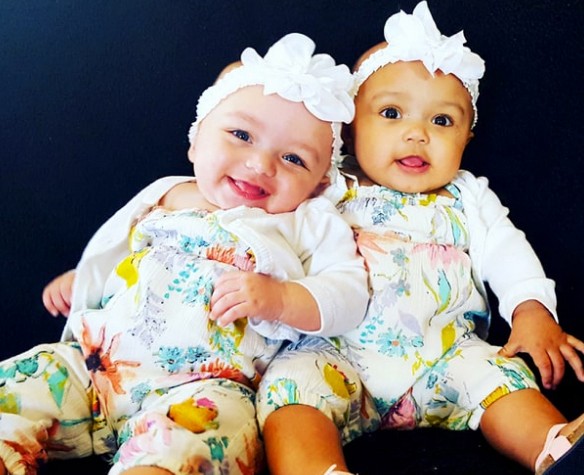 Son gemelas, pero con distinto color de piel: la emocionante historia de Kalani y Jarani | Redes