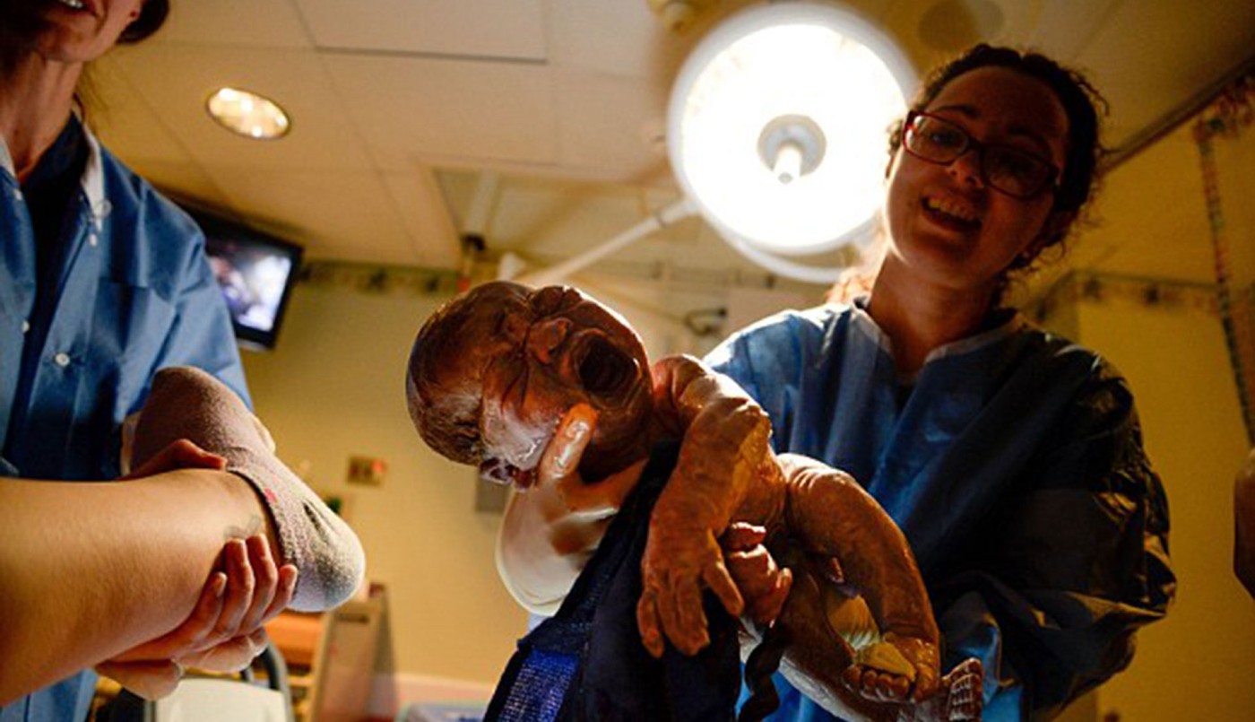 ¿No será mucho? una mujer llevó una cámara de fotos a su parto para fotografiar el momento | Redes