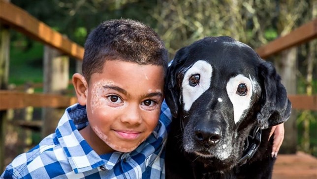 El emocionante momento en que un chico con vitiligo conoce a un perro con la misma condición | Redes