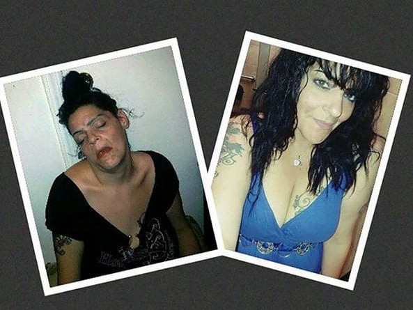 Adicta en recuperación publicó sus fotos del antes y el después para concientizar | Redes
