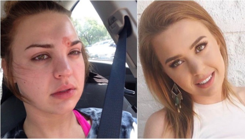 Se explotó un granito y casi termina en tragedia | Redes