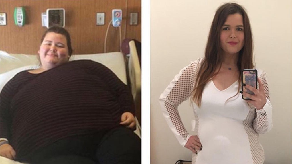 La joven que bajó 92 kilos tras la advertencia de su madre | Redes