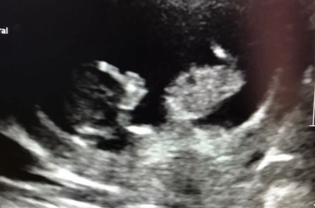 La extraña ecografía que se hizo viral en Twitter: ¿un bebé fumando un cigarrillo? | Redes