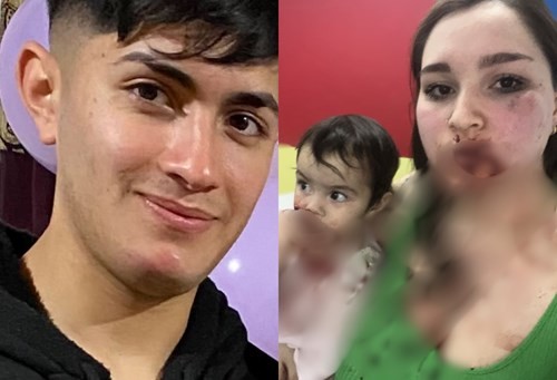 "No sé cómo seguimos vivas": la carta de la joven que fue apuñalada en la cara por su pareja | Actualidad