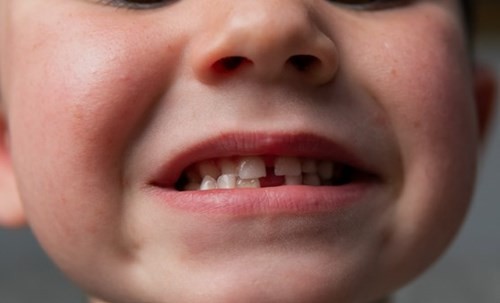 Madre le dio cocaína a su hijo de 4 años por dolor de muelas: 7 años de prisión | Actualidad