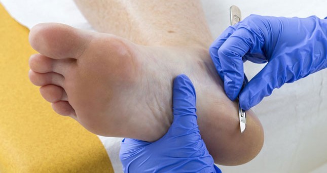 Cuando los pies hablan de nuestra salud: qué enfermedades del cuerpo pueden detectarse a tiempo con una consulta al podólogo | Actualidad