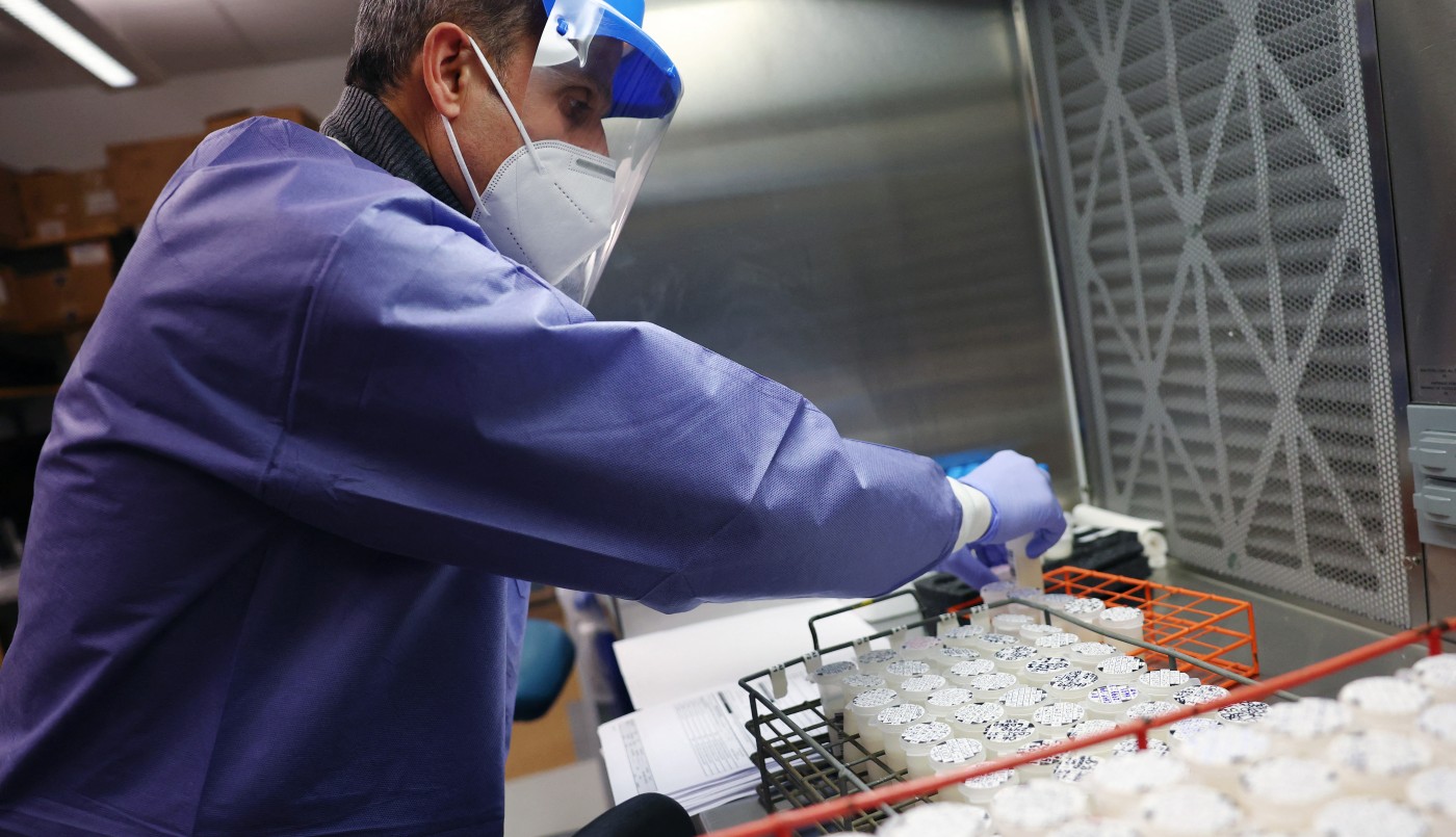 Confirman el primer caso de una variante más contagiosa de viruela símica en Argentina | Actualidad