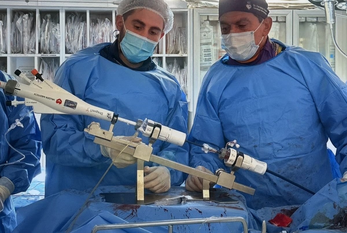 Se realizó el primer implante percutáneo para pacientes de alto riesgo en San Luis | Actualidad