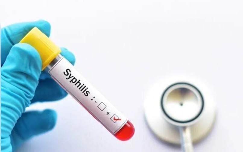 Alerta sífilis: en 2025 hubo más de 46.000 casos | Actualidad